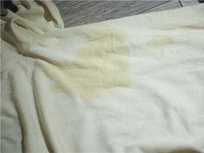 Желтые пятна на белом белье, проявившиеся после стирки